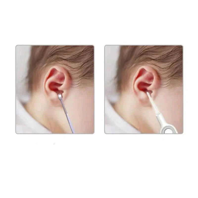Baby Ear Cleaner Earwax Remover Luminous Earpick with LED light for safe use