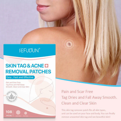 Professional Skin Tag Remover Patches - Discreet, Effective, and Scar-Free Skin Tag Removal Solution
