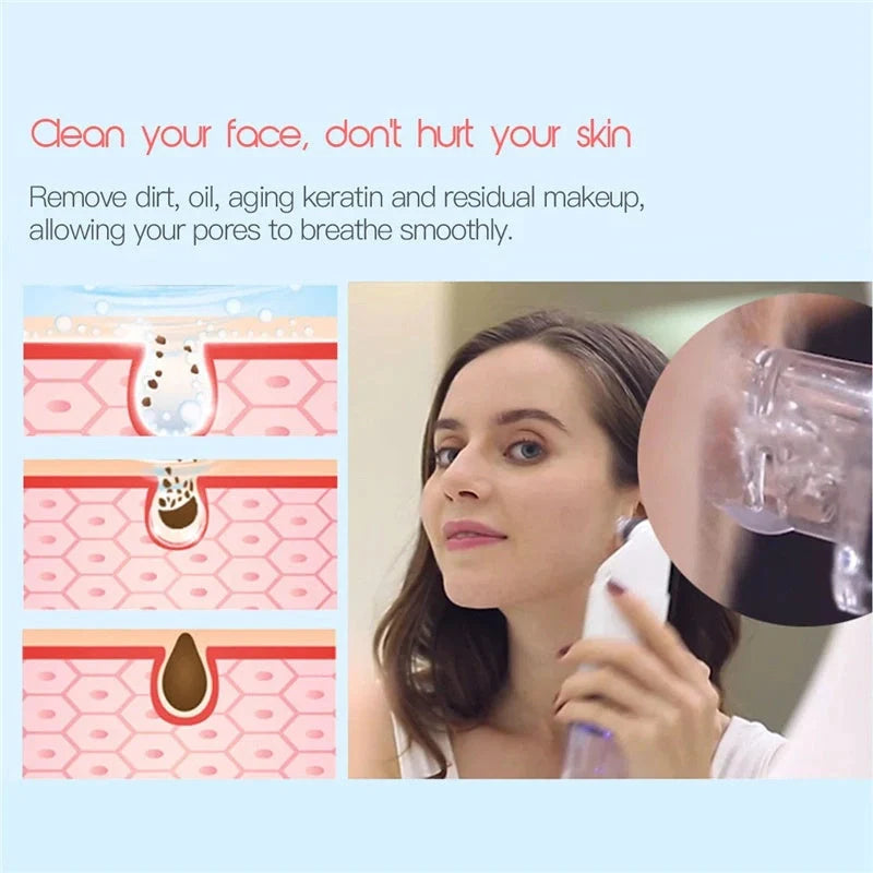 Electric Facial Cleaning Vacuum with multiple heads for deep skin cleansing