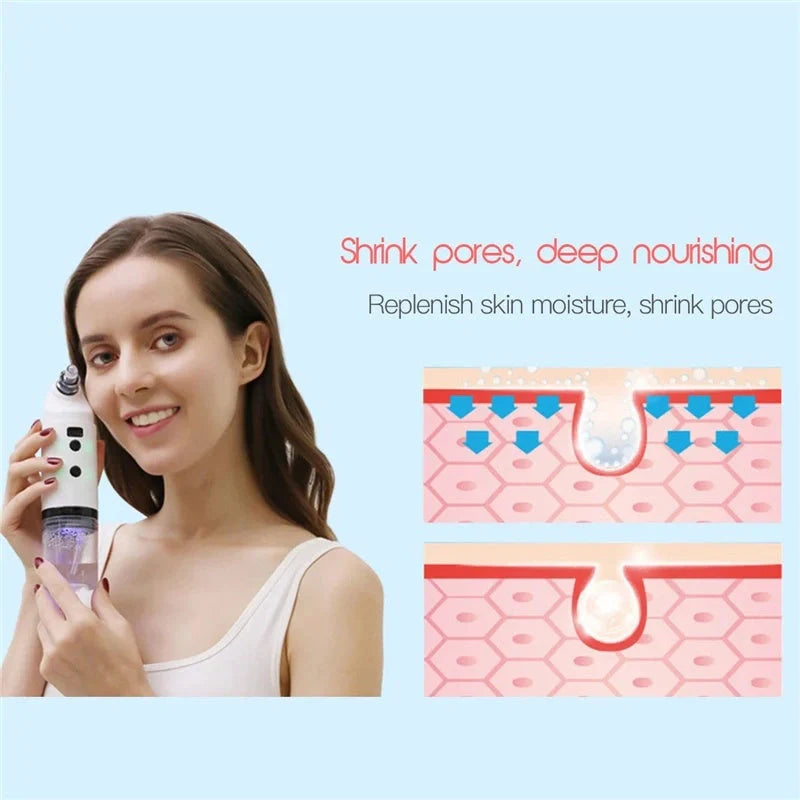 Electric Facial Cleaning Vacuum with multiple heads for deep skin cleansing