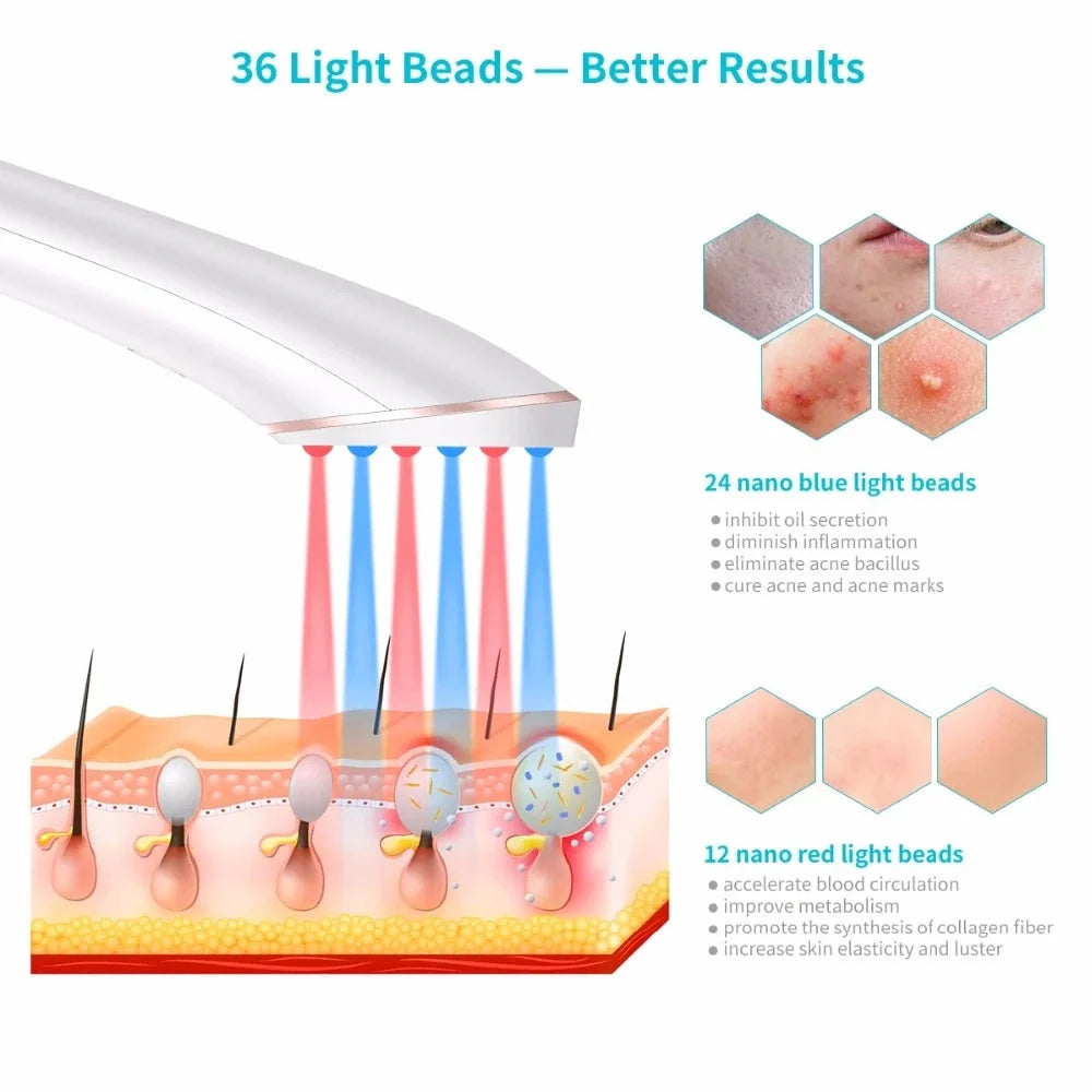 Xpreen Wireless Rechargeable Acne Treatment Device with Blue and Red Light Therapy
