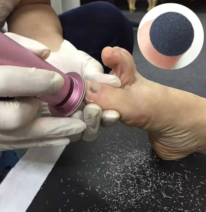 Rechargeable electric pedicure tool for dead skin and callus removal with sandpaper disks