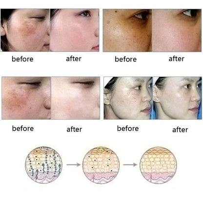Dredge Meridian Skin Care Oil - a natural formula that fades dark spots, discoloration, and imperfections for brighter, smoother skin