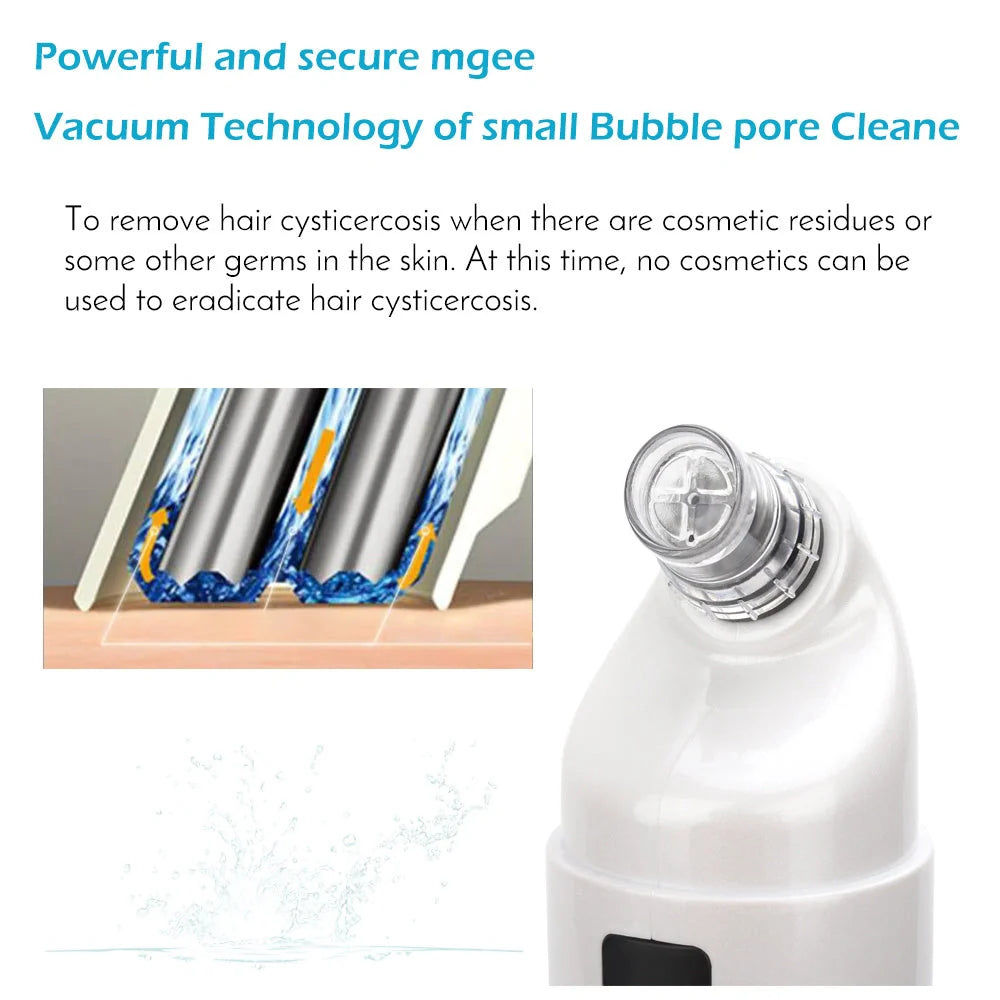 Electric Facial Cleaning Vacuum with multiple heads for deep skin cleansing