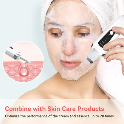 Ultrasonic Skin Scrubber in white for deep facial cleansing and blackhead removal