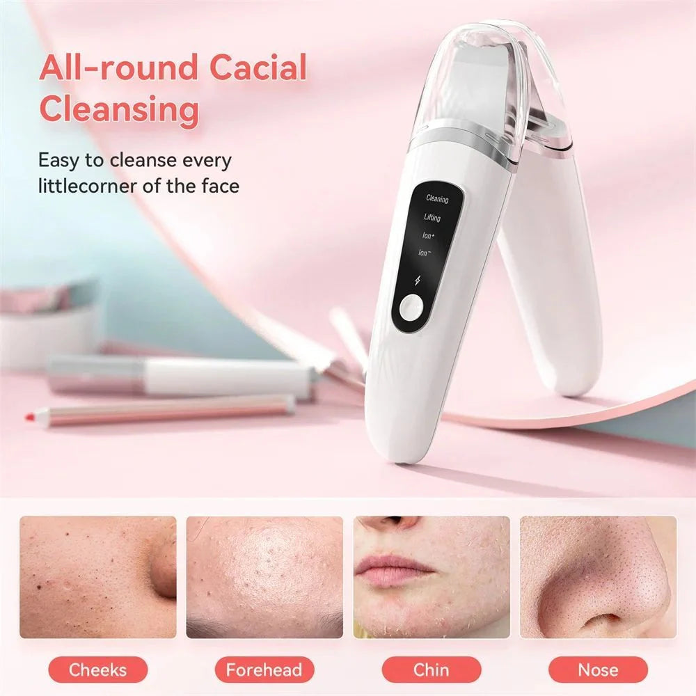 Ultrasonic Skin Scrubber in white for deep facial cleansing and blackhead removal