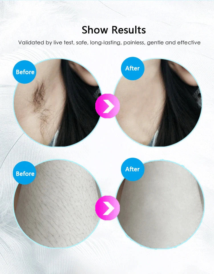 Premium laser hair removal device with adjustable intensity levels for smooth, hair-free skin