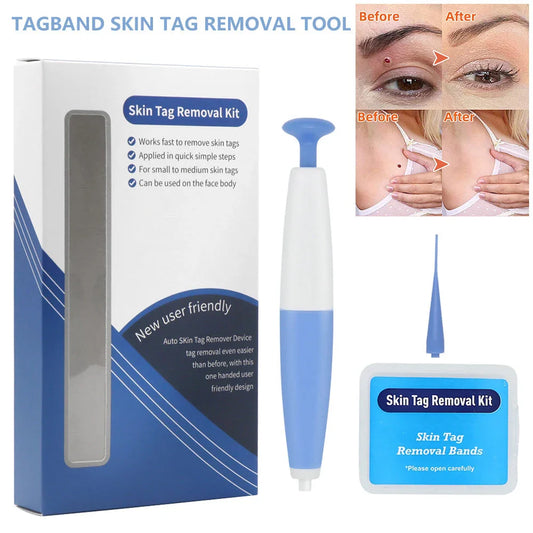Skin Tag Removal Kit with Precision Micro-Tool and Reusable Removal Bands for Safe, Effective At-Home Use