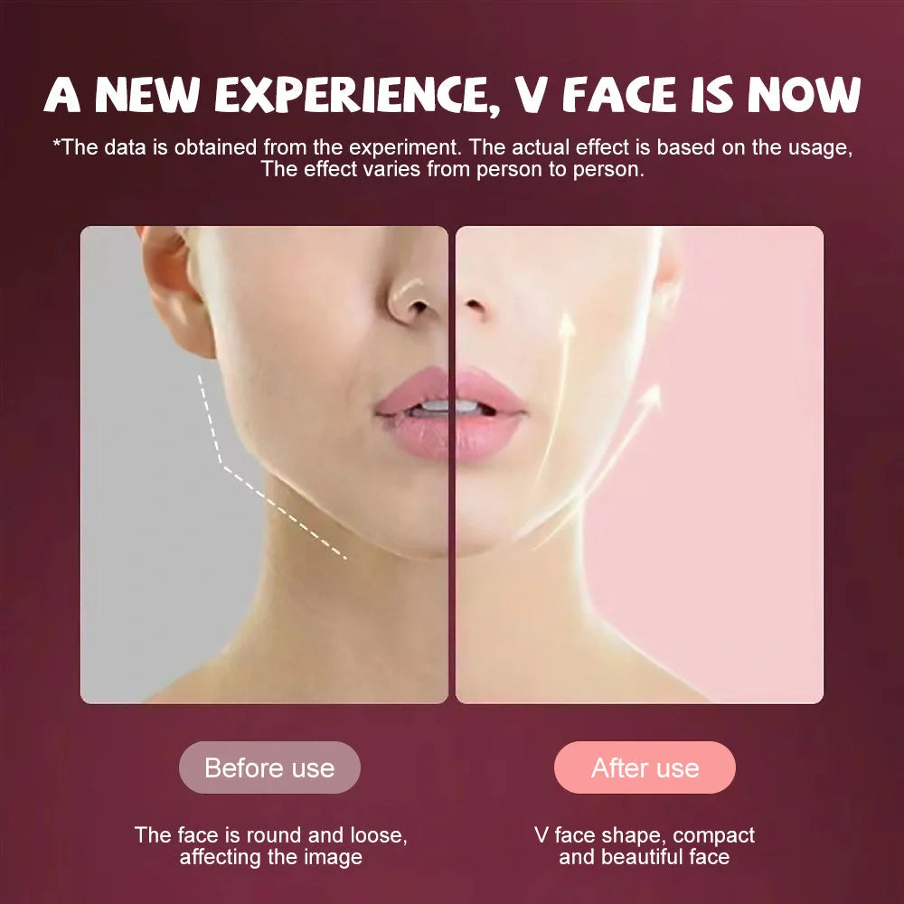 Microcurrent Face Massager with EMS and LED Photon Therapy for V Shape Slimming
