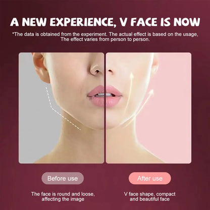 Microcurrent Face Massager with EMS and LED Photon Therapy for V Shape Slimming