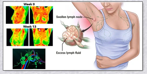Lymph Detox Magnetic Bracelet - A premium accessory designed to promote lymphatic health and detoxification