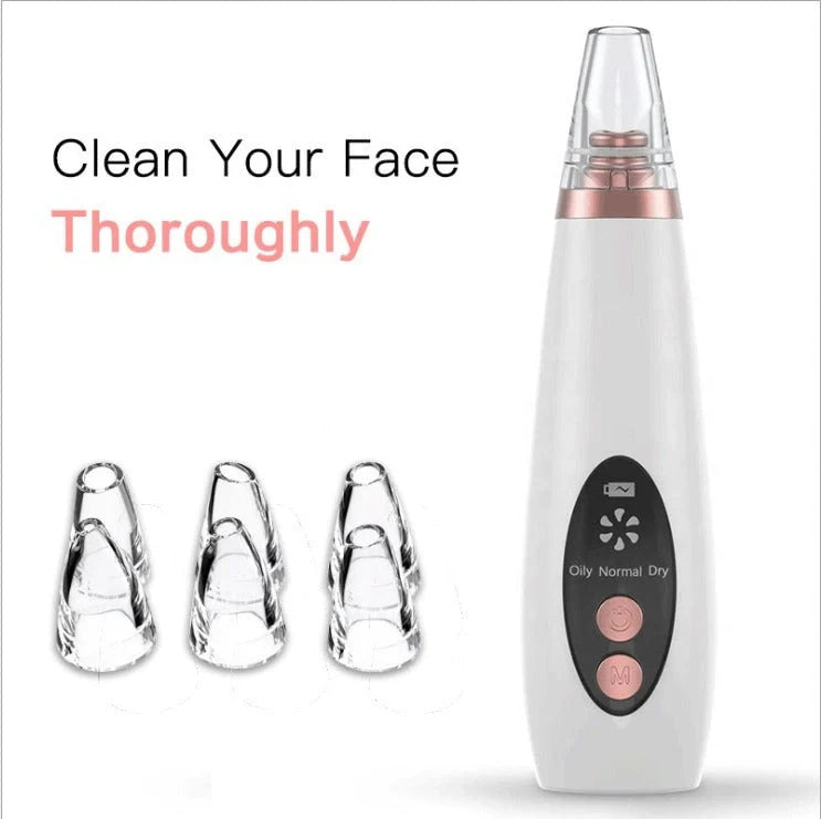 Premium blackhead removal device with advanced suction technology for a clear, radiant complexion