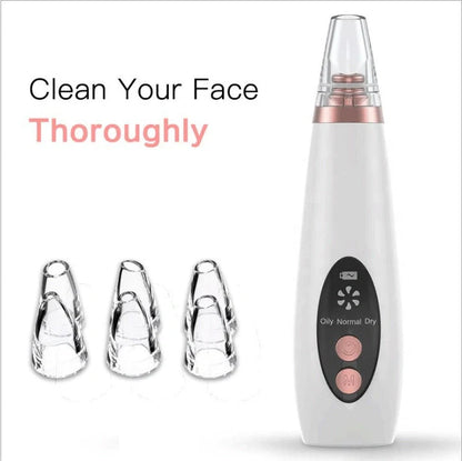 Premium blackhead removal device with advanced suction technology for a clear, radiant complexion