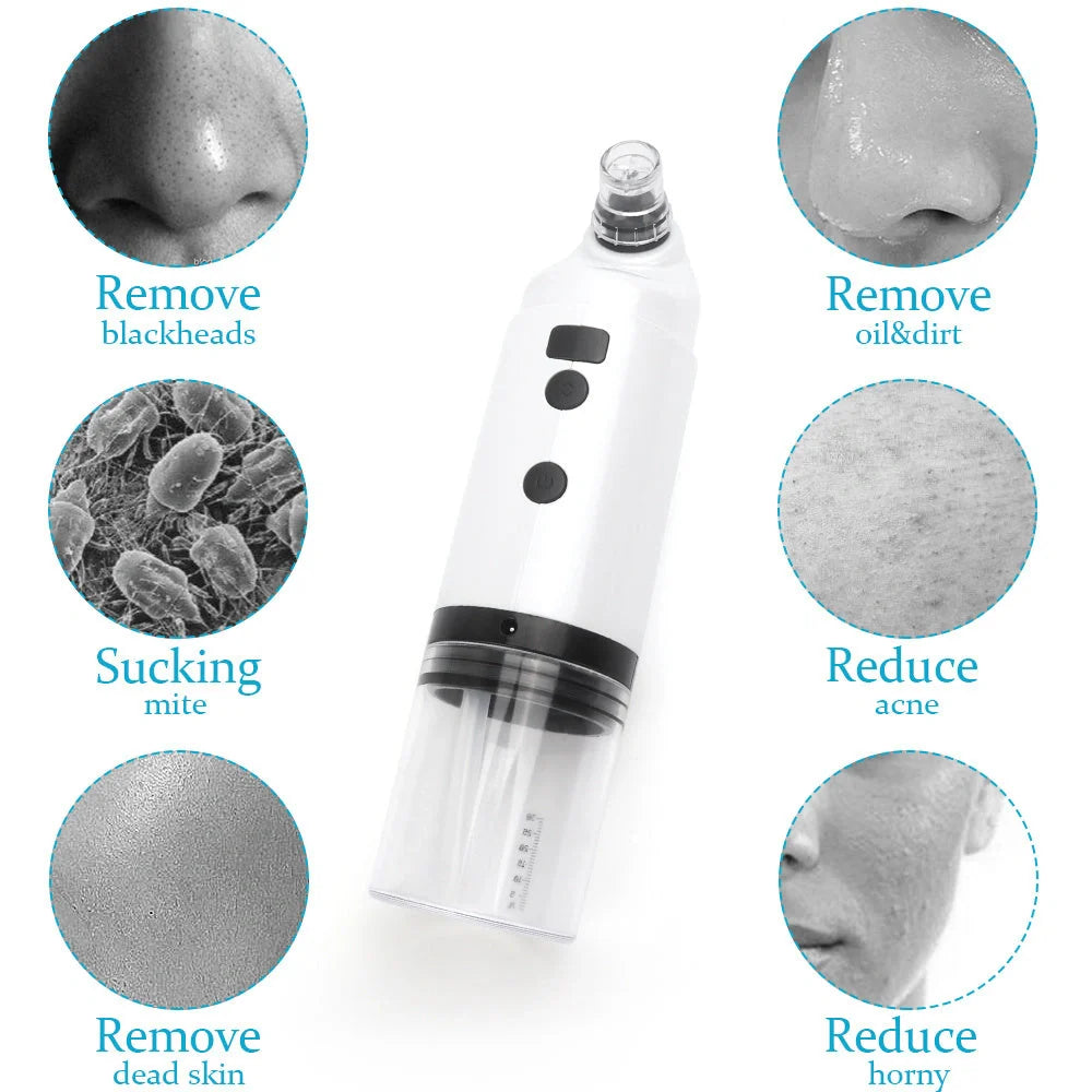 Electric Facial Cleaning Vacuum with multiple heads for deep skin cleansing