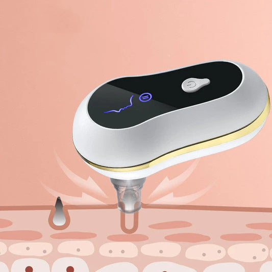 An electric pore vacuum cleaner with a white body and USB power source, designed to deep clean pores and remove blackheads for smooth, radiant skin.