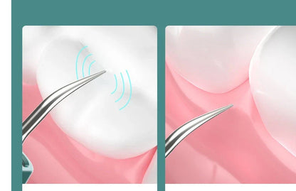 Close-up view of the high-powered dental cleaning tool with visual assistance and stainless steel construction