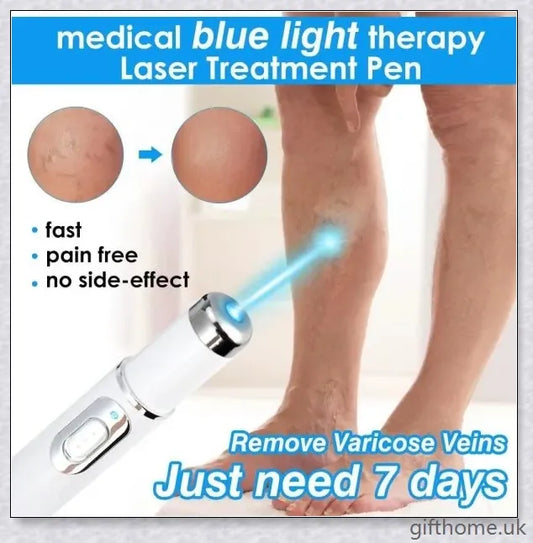BlueLight Therapy Pen for Varicose Veins - Safe, Effective, and Convenient Home Remedy for Eliminating Unsightly Veins