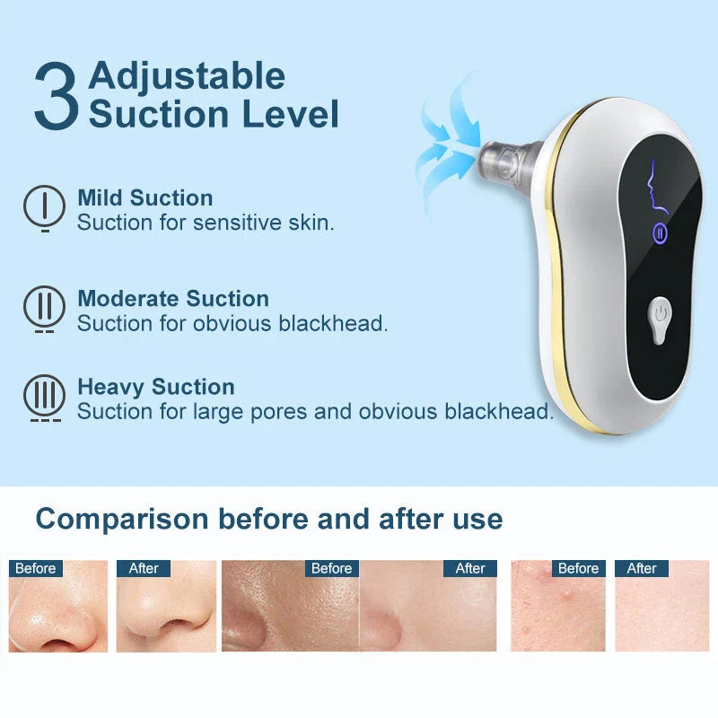 An electric pore vacuum cleaner with a white body and USB power source, designed to deep clean pores and remove blackheads for smooth, radiant skin.