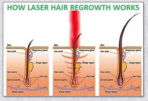 Professional Hair Regrowth Laser Comb with laser technology for stimulating hair growth and reducing hair loss