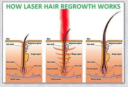 Professional Hair Regrowth Laser Comb with laser technology for stimulating hair growth and reducing hair loss