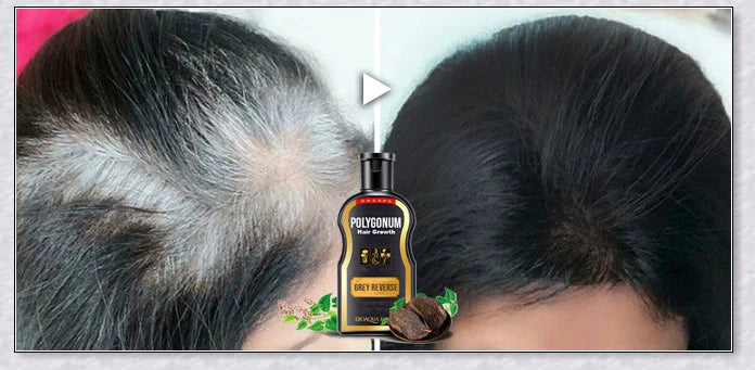 Grey Reverse Hair Darkening Shampoo - Restore natural hair colour and boost hair growth
