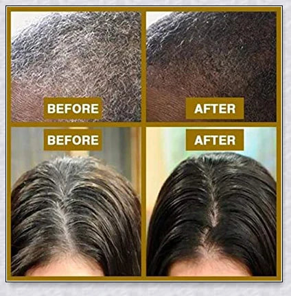 Grey Reverse Hair Darkening Shampoo - Restore natural hair colour and boost hair growth