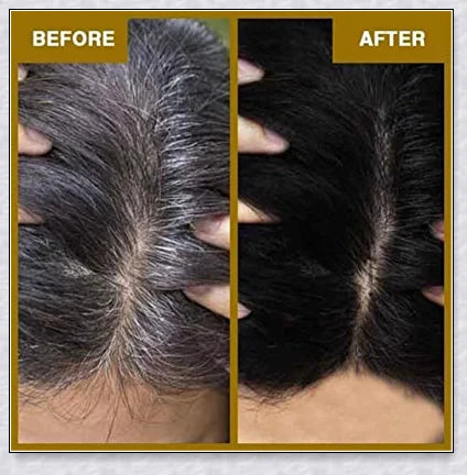Grey Reverse Hair Darkening Shampoo - Restore natural hair colour and boost hair growth