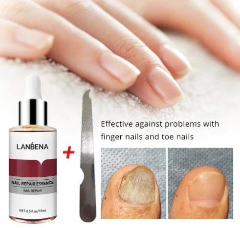 12ml nail repair and care essence bottle with dropper for precise application