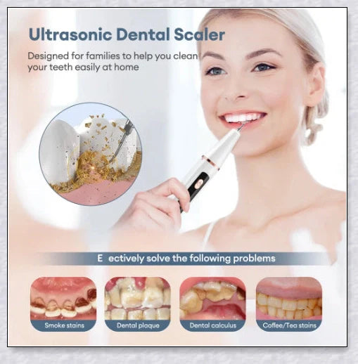 Ultrasonic dental scaler for deep cleaning and plaque removal, with multiple cleaning modes and a rechargeable battery for convenient use.