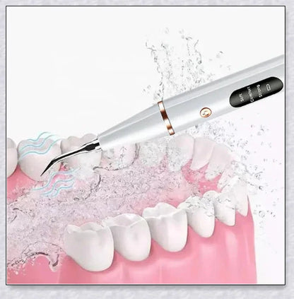 Ultrasonic dental scaler for deep cleaning and plaque removal, with multiple cleaning modes and a rechargeable battery for convenient use.