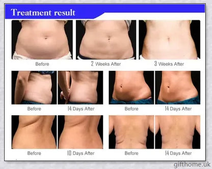 Body Slimming and Anti-Cellulite Massager with Ultrasonic Cavitation Fat Burning Technology