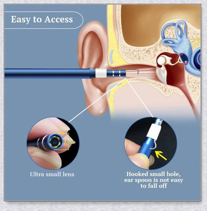 Premium Digital Phone Otoscope Camera with 3-in-1 USB compatibility for Android, Windows, and Mac devices