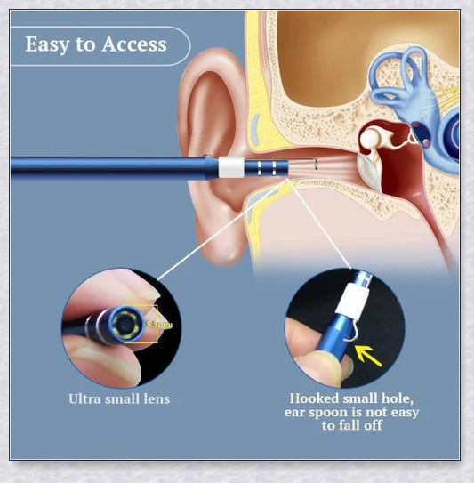 Premium Digital Phone Otoscope Camera with 3-in-1 USB compatibility for Android, Windows, and Mac devices