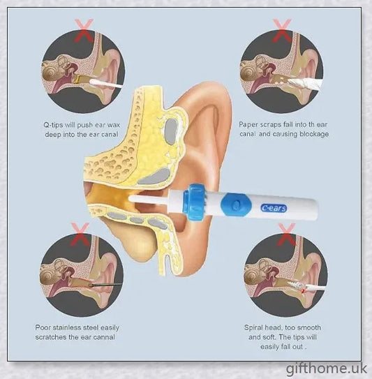 Ear Wax Vacuum Cleaner Removal Kit - Powerful suction tool for safe and effective earwax removal