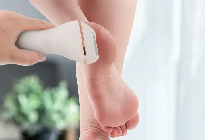 Electric Foot Grinder with USB charging for dead skin removal