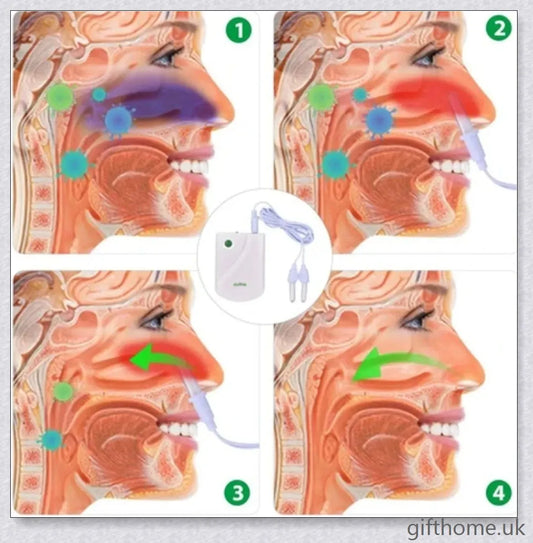 Bionase Infrared Rhinitis Therapy Device for Allergy Relief in the UK
