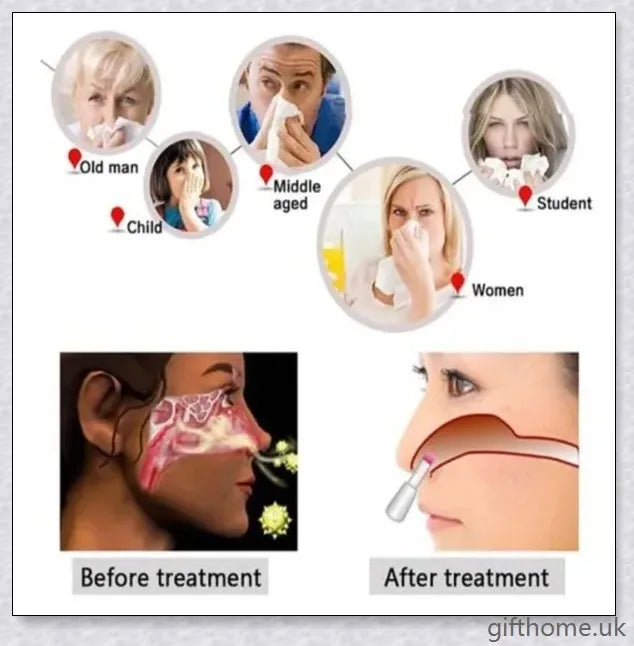 Bionase Infrared Rhinitis Therapy Device for Allergy Relief in the UK