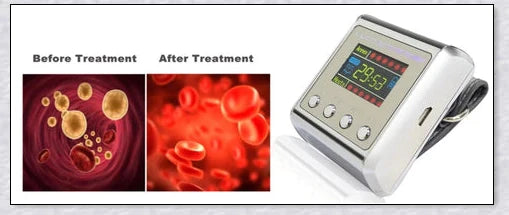 The Hypertension Laser Therapy Watch, a cutting-edge device that uses low-intensity laser therapy to improve blood circulation and manage hypertension.