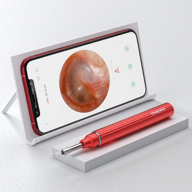 3.9mm WiFi Ear Cleaner with HD camera for real-time earwax removal and inspection