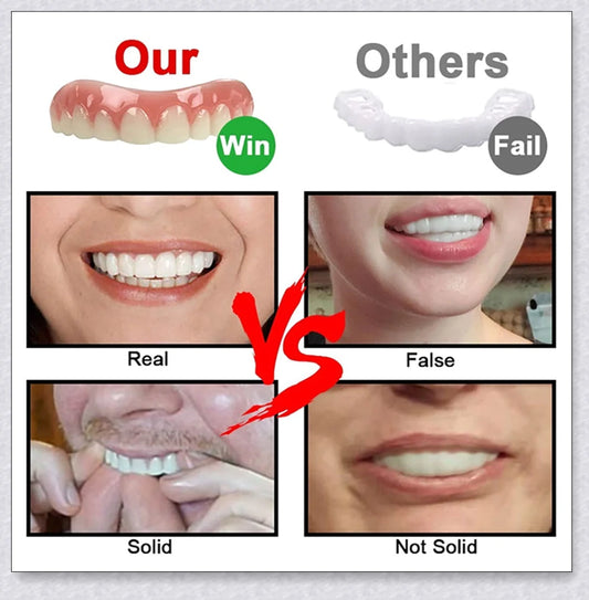 Magic Teeth Brace Veneer - Custom-fitted dental veneers to instantly transform your smile