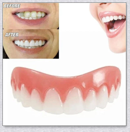 Magic Teeth Brace Veneer - Custom-fitted dental veneers to instantly transform your smile
