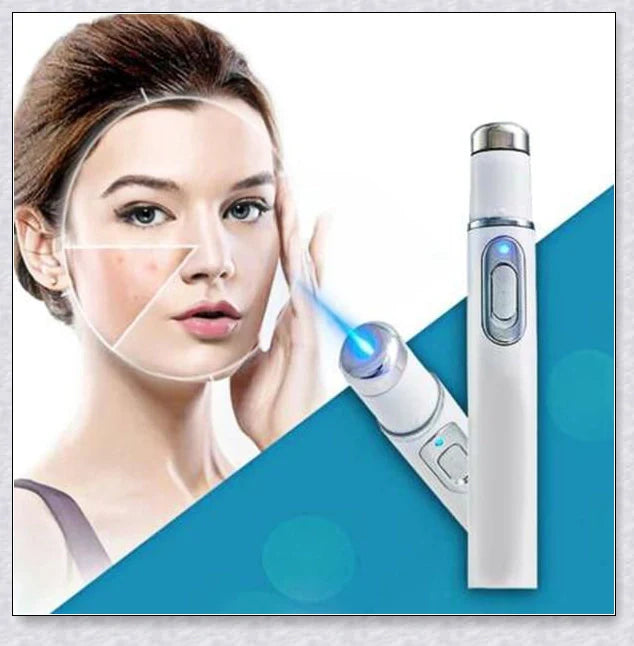 Blue Light Laser Pen for Effortless Spot Removal at Home