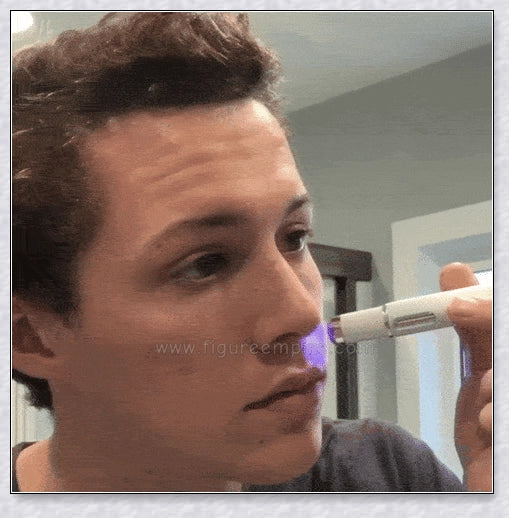 Blue Light Laser Pen for Effortless Spot Removal at Home