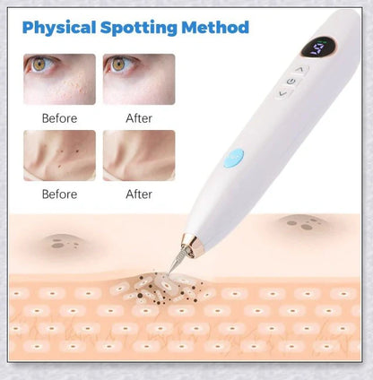 Skin Tag Wart Mole Remover Plasma Pen - Convenient at-home solution for removing skin imperfections