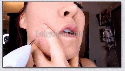 Skin Tag and Mole Remover - Innovative nano-needle technology for safe, effective blemish removal