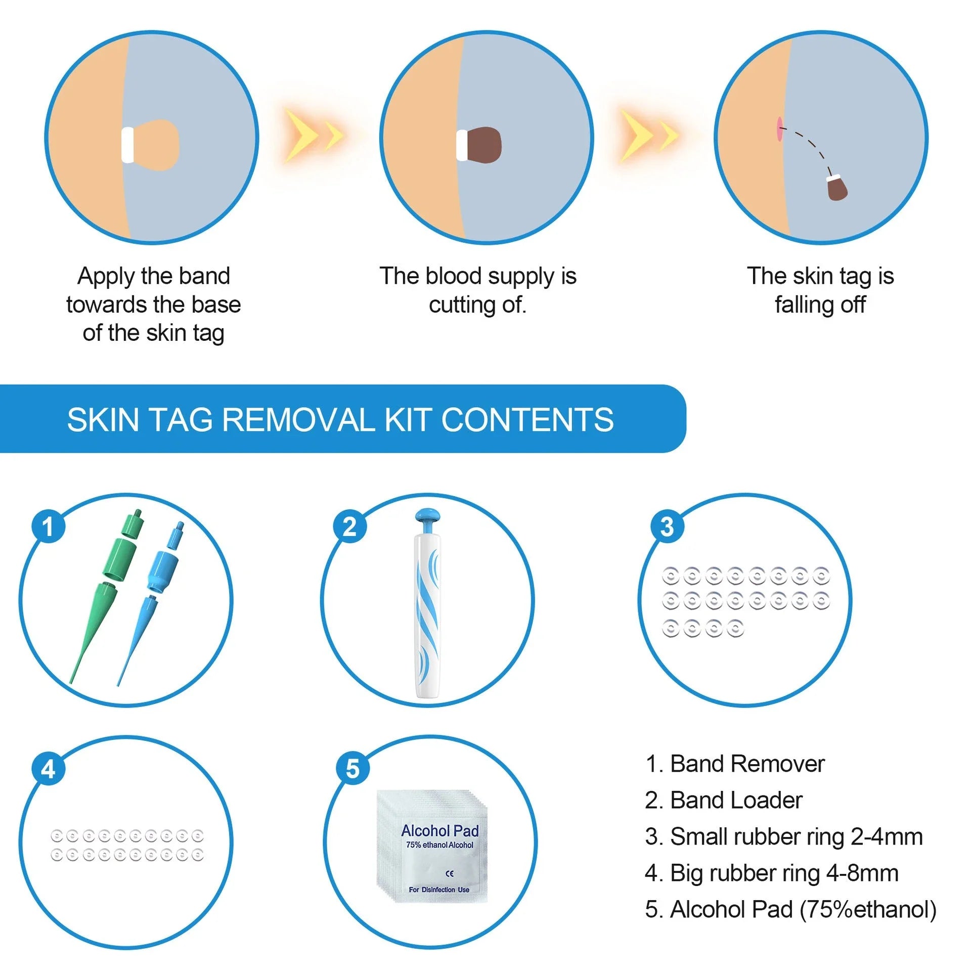 Skin Tag Remover Kit featuring rubber band removal tool, attachments for different tag sizes, and easy-to-clean design for safe at-home use
