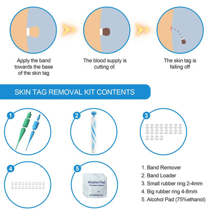 Skin Tag Remover Kit featuring rubber band removal tool, attachments for different tag sizes, and easy-to-clean design for safe at-home use