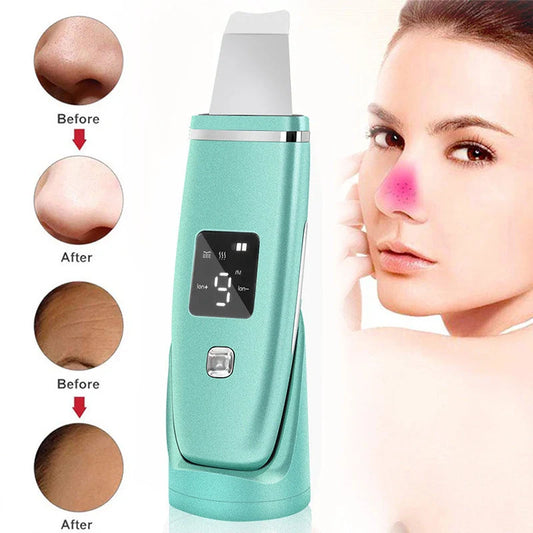 Ultrasonic Vibration Blackhead Remover with LED display and stainless steel shovel