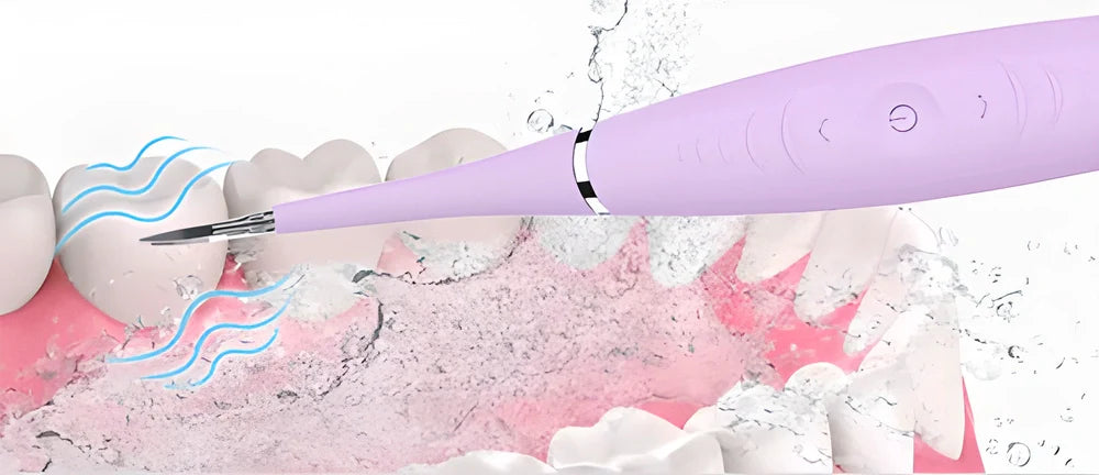Premium ultrasonic dental scaler with adjustable power settings and waterproof design for effortless at-home teeth cleaning