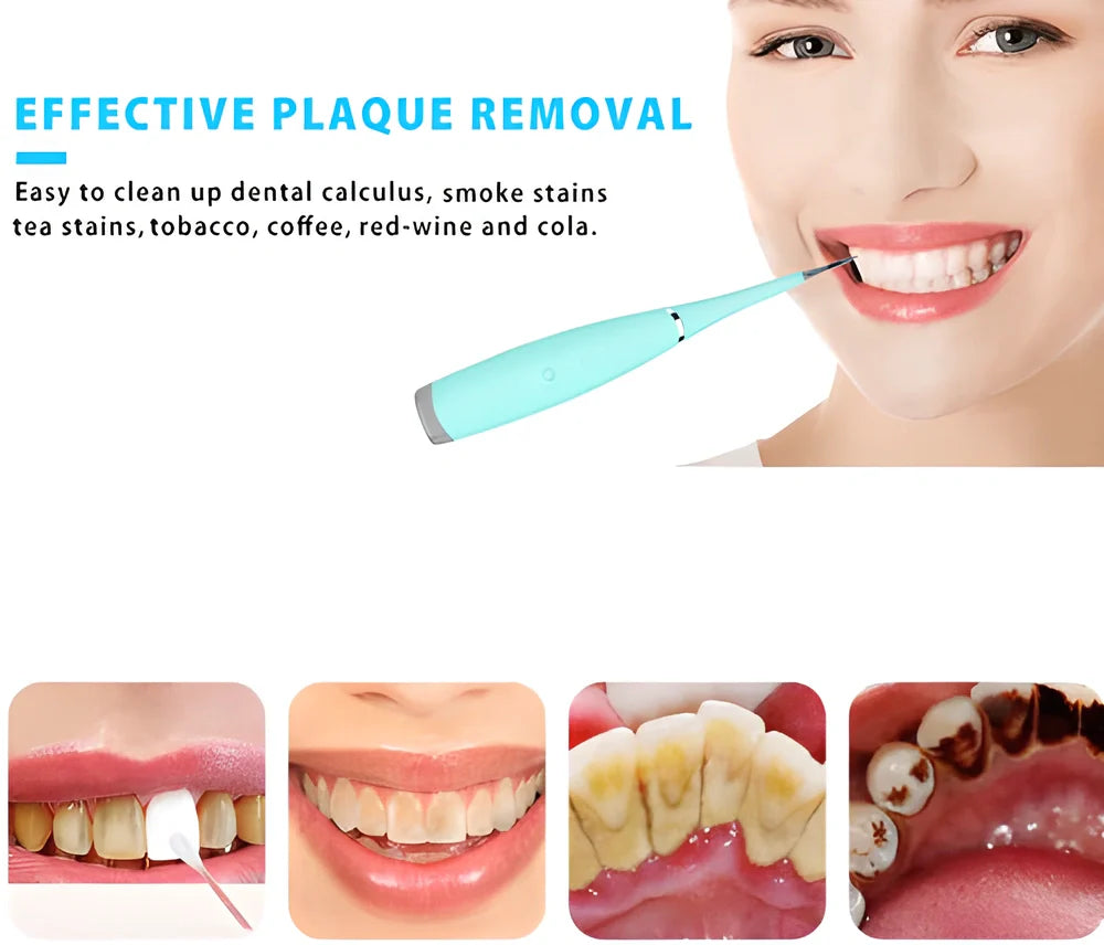 Premium ultrasonic dental scaler with adjustable power settings and waterproof design for effortless at-home teeth cleaning